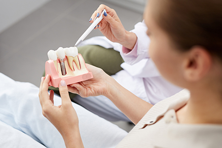 Dentistry on the Square | Crowns, Dentures and Root Canals